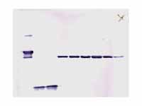 A Western blot.