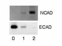 Western blot autoradiogram