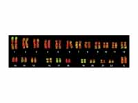 Karyotype from a human female lymphoc...