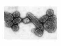 Reconstructed 1918 influenza virus