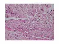 Peripheral nerve cross section