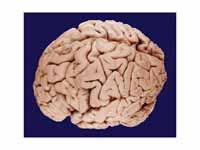 The human brain