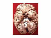 The three divisions of the brainstem ...