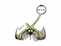 The left optic nerve and the optic tr...