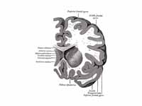 Coronal section through anterior corn...