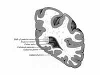 Coronal section through posterior cor...