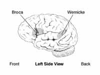 Approximate location of Broca's area ...