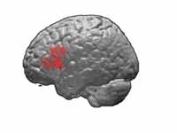 Brodmann area 45.  BA45 is in the fro...