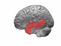 Brodmann area 21.  BA 21 lies on the ...