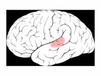 Brodmann areas 41 42 in the temporal ...