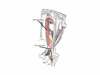 Trochlear nerve