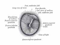 Right tympanic membrane as seen throu...