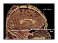 Hypothalamus