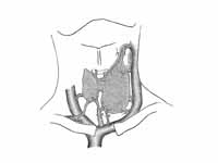 Diagram showing common arrangement of...