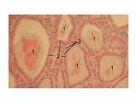 Histological section through the thyr...