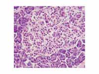 Islets of Langerhans, haemalum-eosin ...