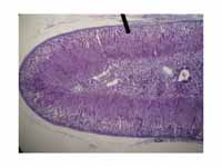 Cortical part of the adrenal gland (o...