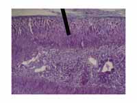 Adrenal gland (zona fasciculata layer).