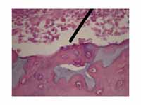 Osteoblasts in developing bone