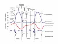 Cardiac events occuring in a single c...