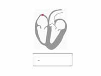 Animation - Principle of ECG formation