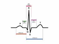 Schematic diagram of normal sinus rhy...