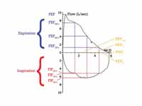 Flow-Volume loop showing successful F...