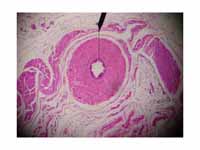 Cross-section of vas deferens through...